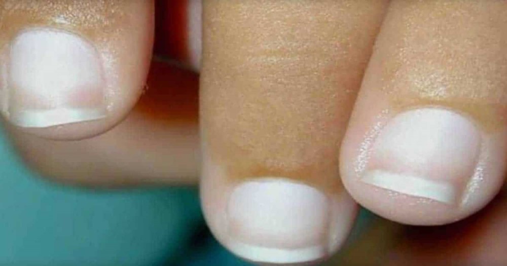 What Your Fingernails Say About Your Health